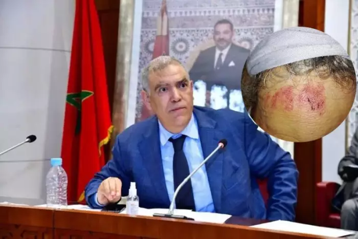 مقدم وشيخ يعتديان على معاق وزوجته بسطات..بئر الجمعية يتحول إلى ملك خاص ورائحة فساد تفوح من تحت الأرض