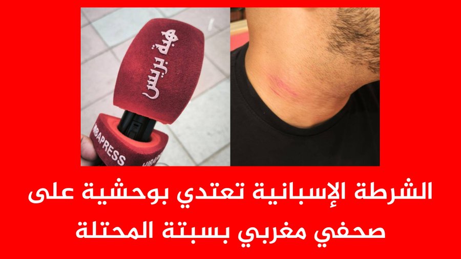 شرطة إسبانيا تُهاجم صحافيا مغربيا في سبتة وتفضح شعار حرية الصحافة بالجارة الإيبيرية