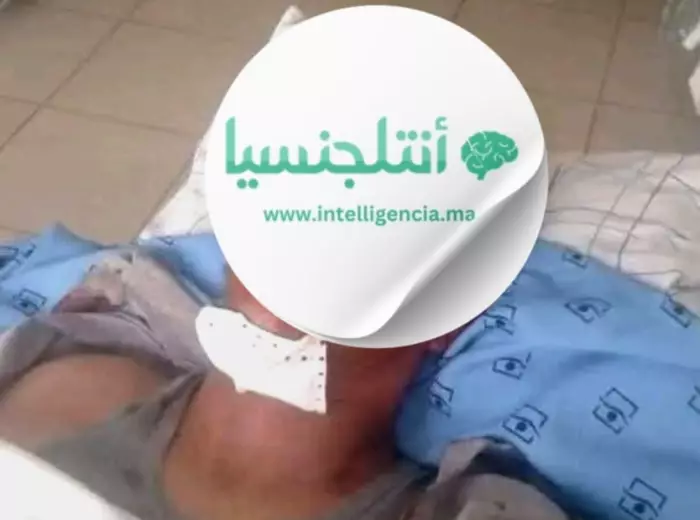 عسكري يبتر عضواً ذكرياً لرجل وجده مع زوجته في أحضان الخيانة